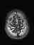 Bild 23